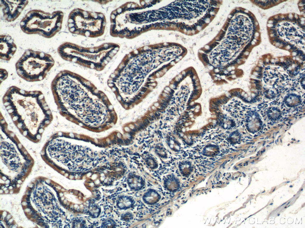 IHC staining of human small intestine using 21098-1-AP