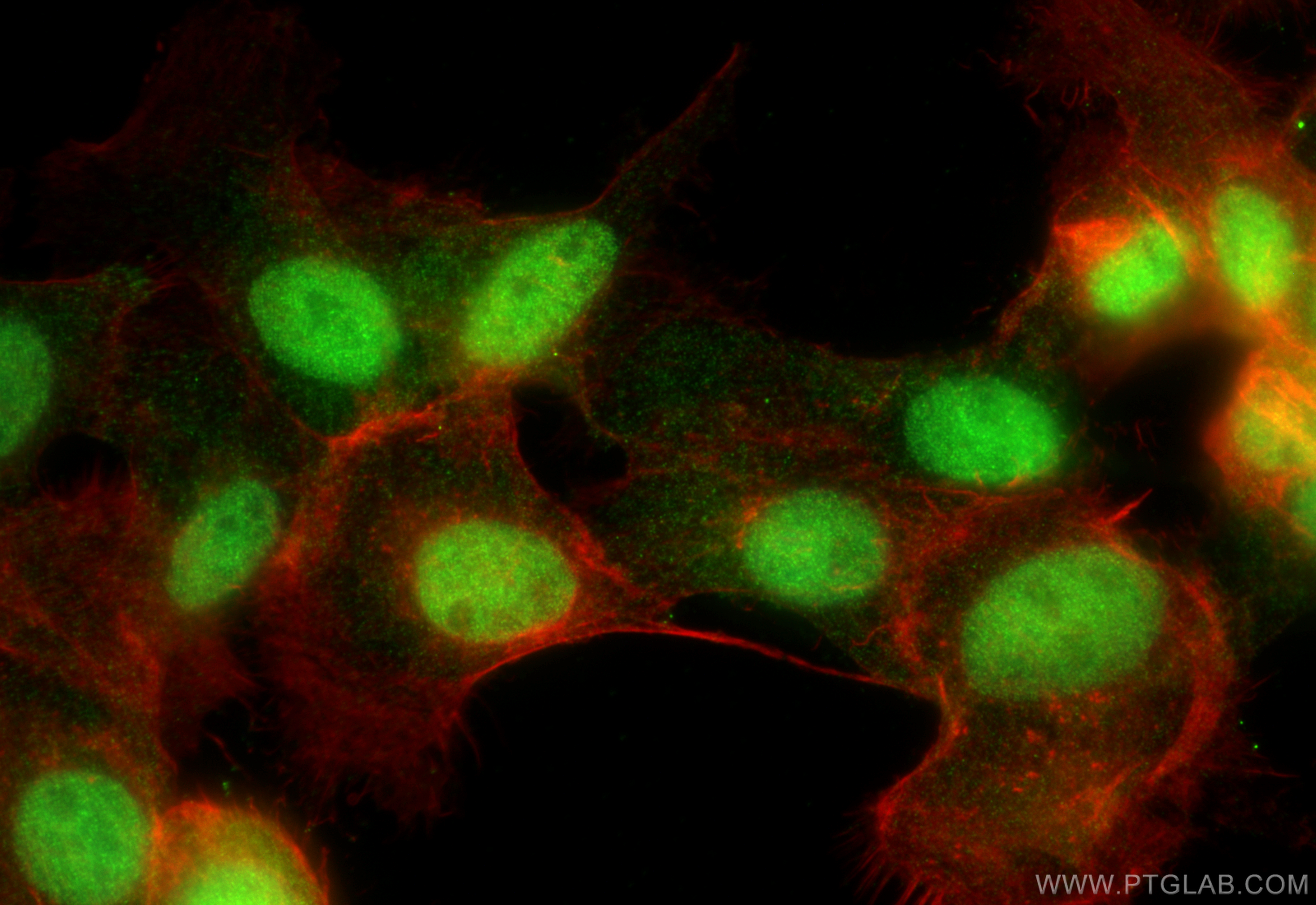 IF Staining of A431 using 26109-1-AP