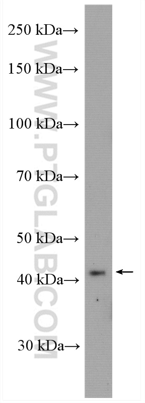 WB analysis of mouse brain using 26109-1-AP