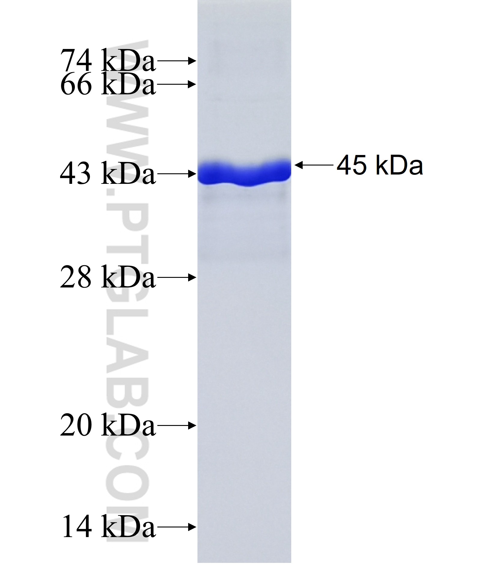 C1orf62 fusion protein Ag36967 SDS-PAGE C1orf62 fusion protein Ag36967 SDS-PAGE