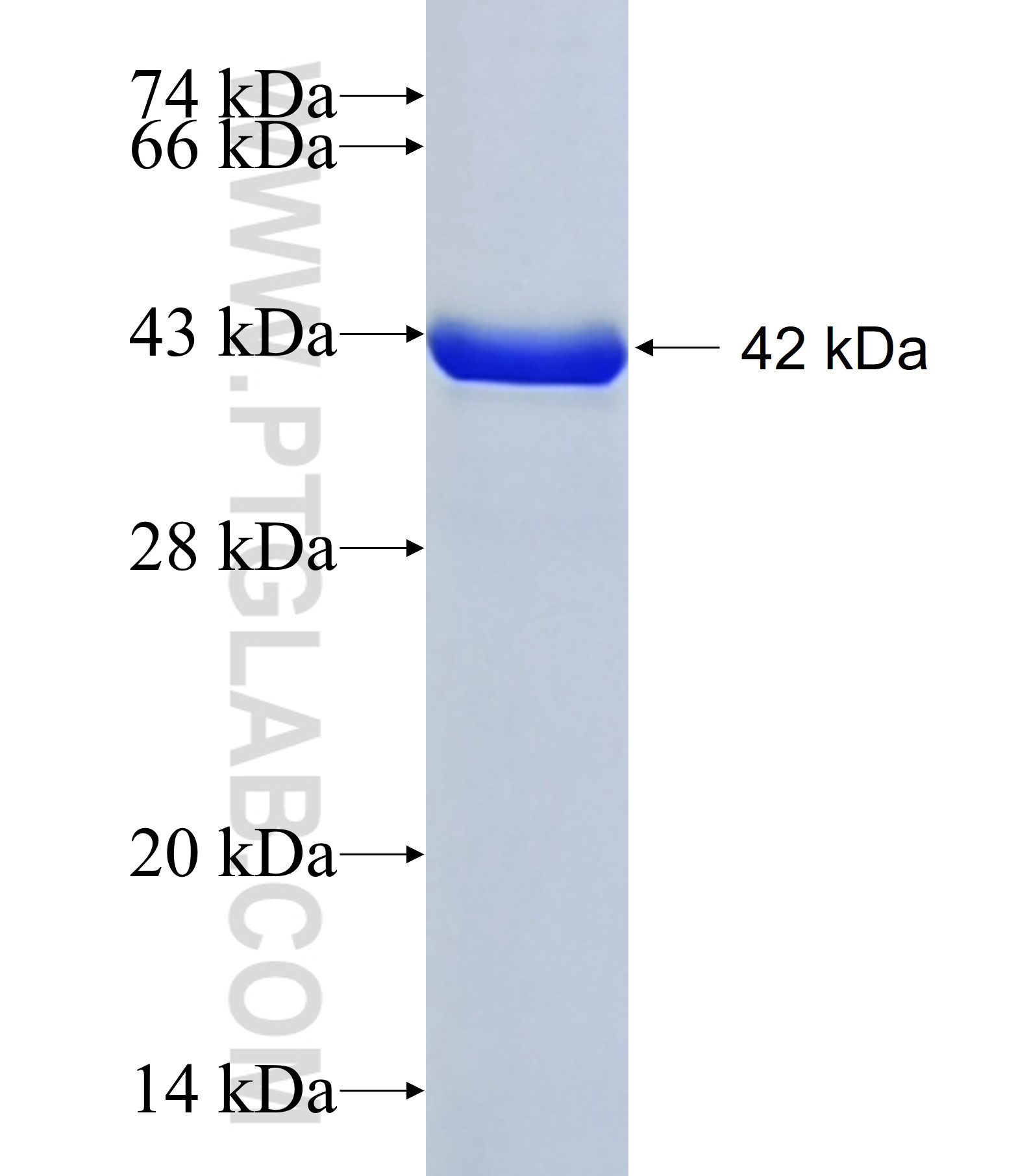 C1orf62 fusion protein Ag41865 SDS-PAGE C1orf62 fusion protein Ag41865 SDS-PAGE