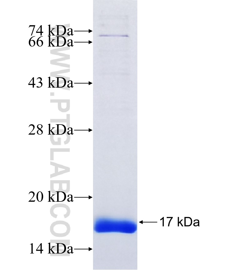 C1orf69 fusion protein Ag36706 SDS-PAGE