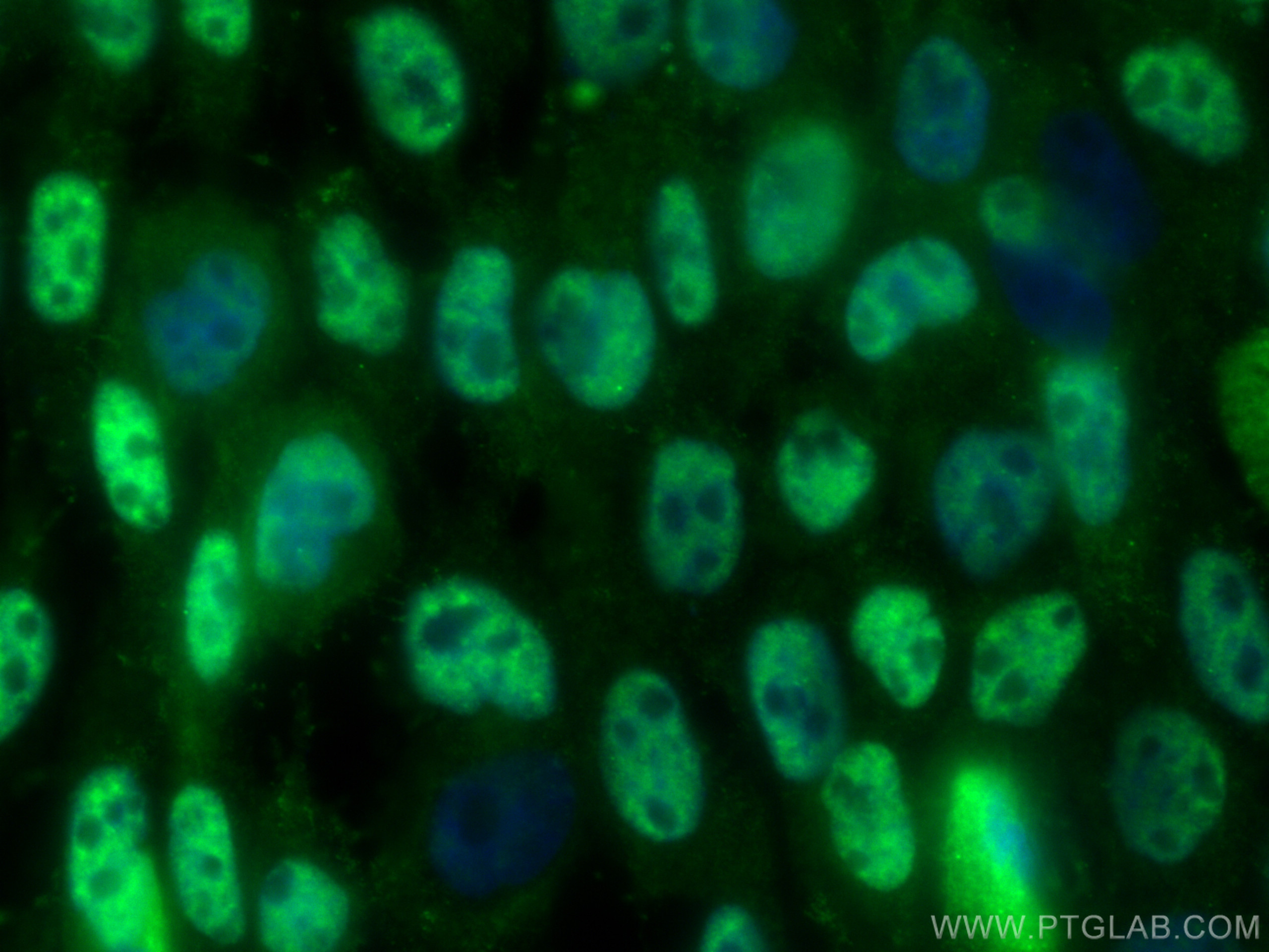 IF Staining of A431 using 27478-1-AP