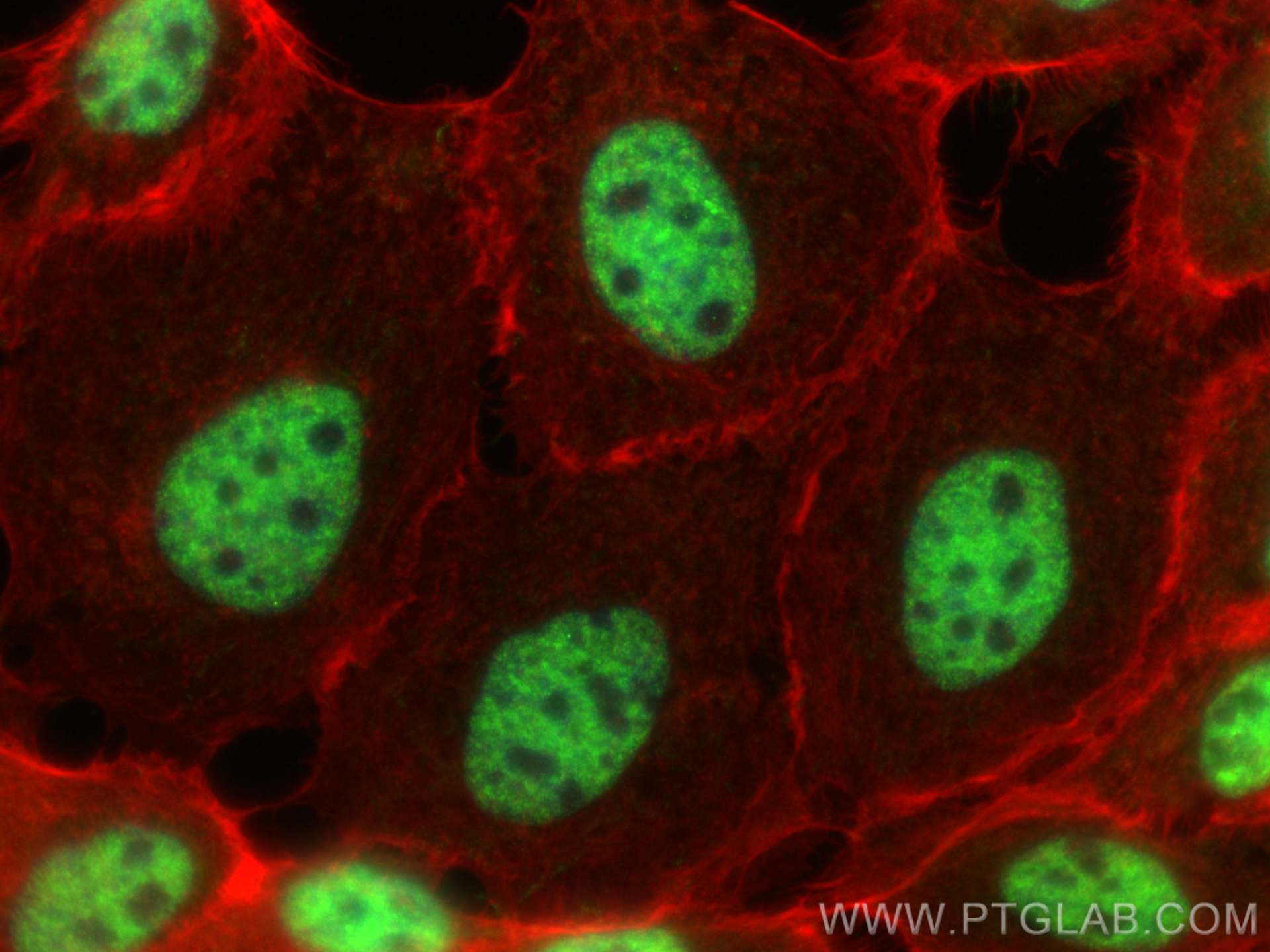 IF Staining of A431 using 27478-1-AP