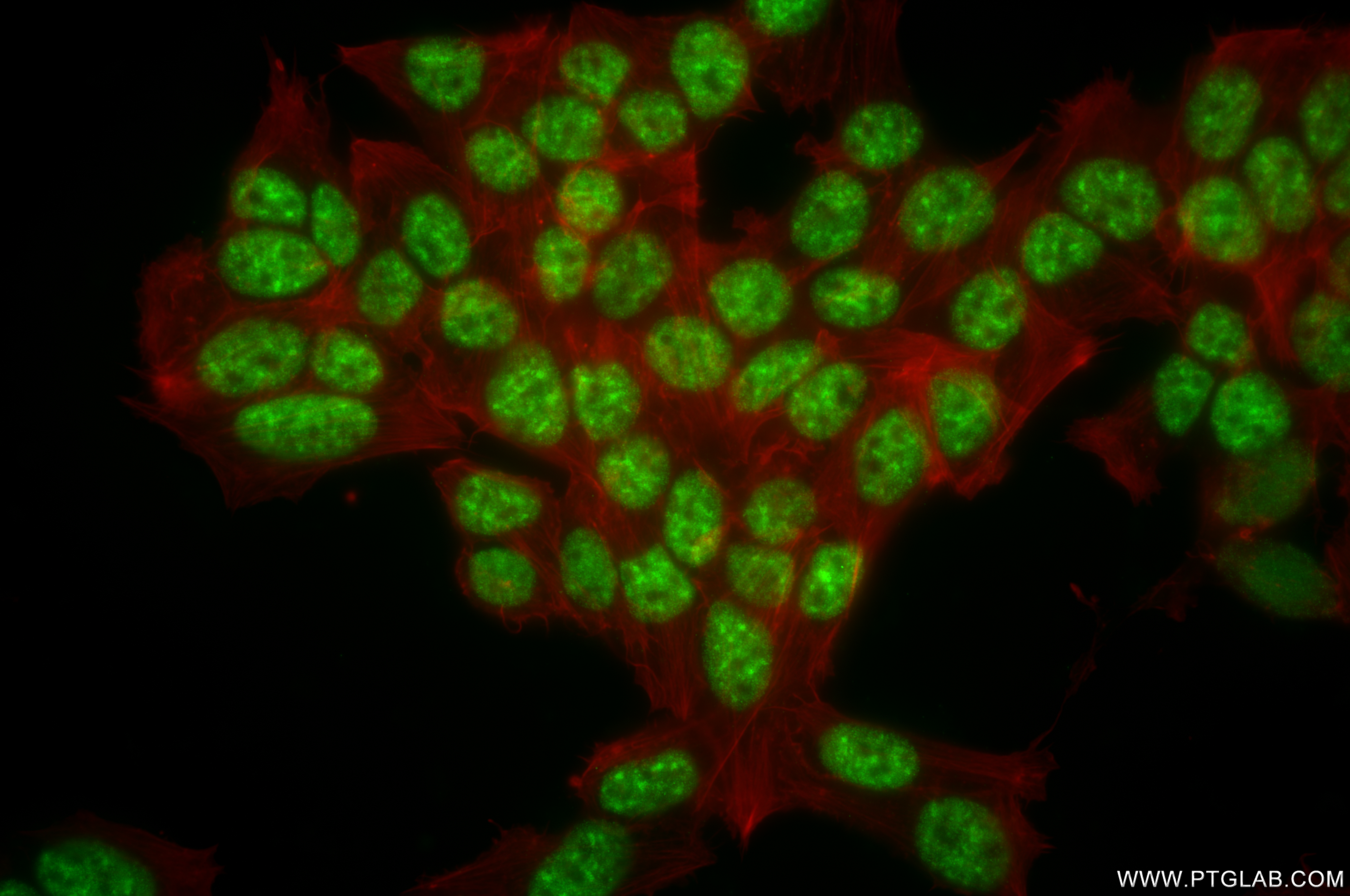 IF Staining of SH-SY5Y using 85147-3-RR (same clone as 85147-3-PBS)