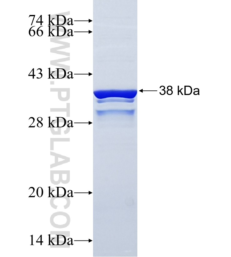 C1orf77 fusion protein Ag26580 SDS-PAGE