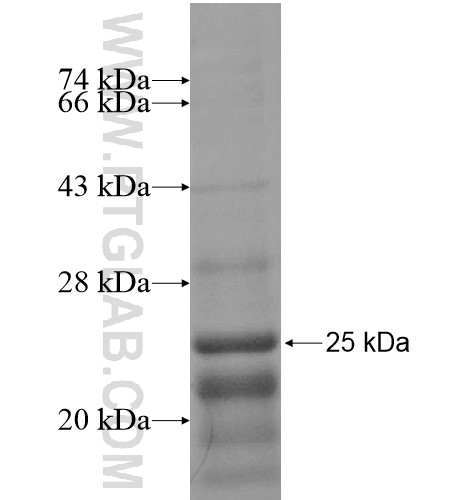 C1orf77 fusion protein Ag14736 SDS-PAGE