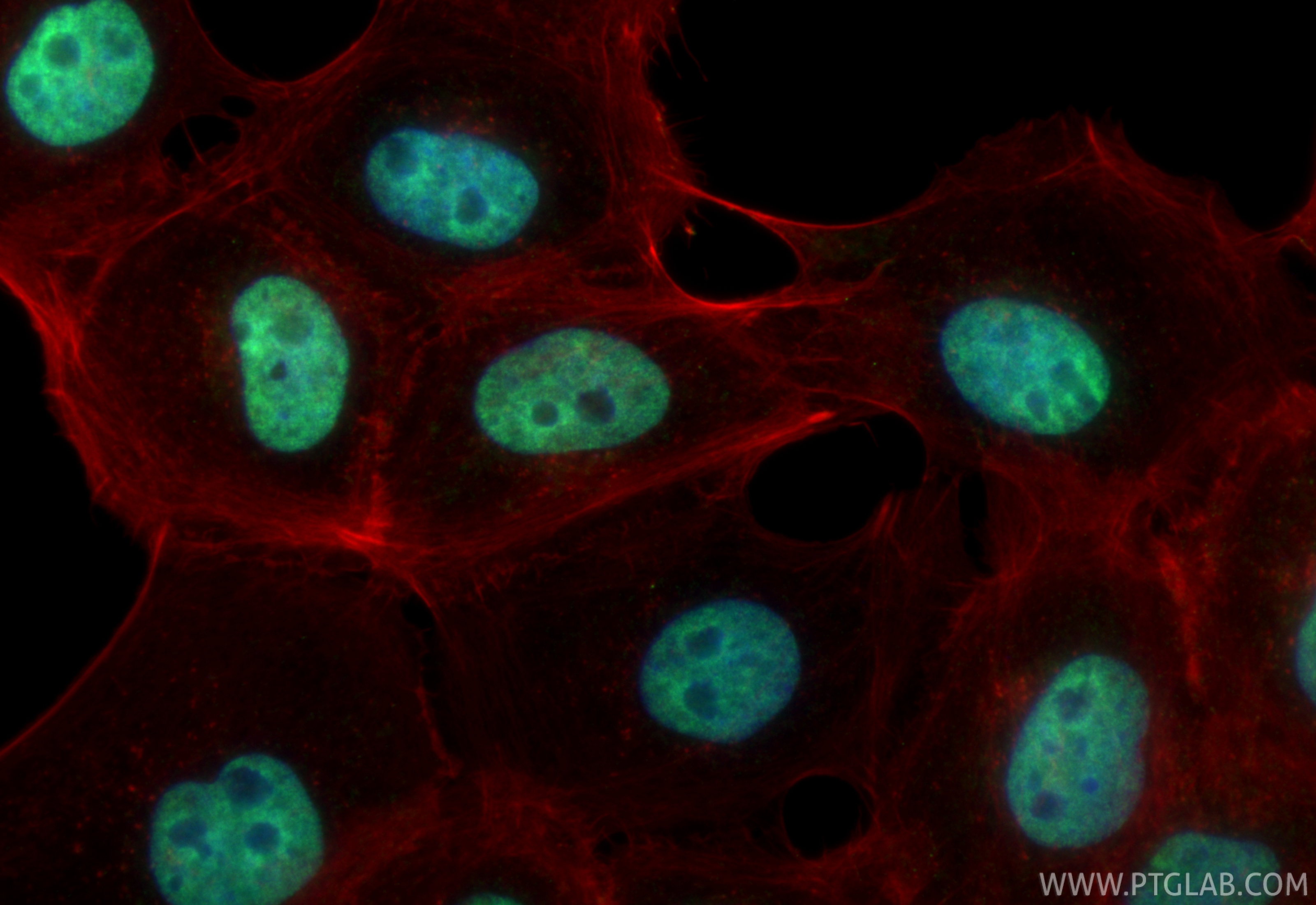 IF Staining of A431 using 20940-1-AP