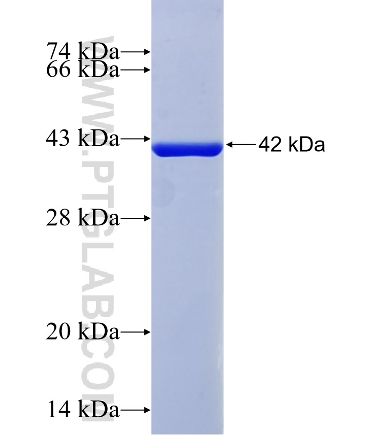 C1orf84 fusion protein Ag36664 SDS-PAGE