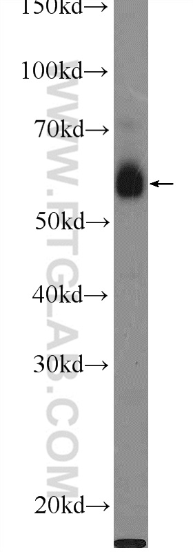 WB analysis of HeLa using 21031-1-AP