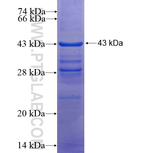 C1orf92 fusion protein Ag15492 SDS-PAGE C1orf92 fusion protein Ag15492 SDS-PAGE