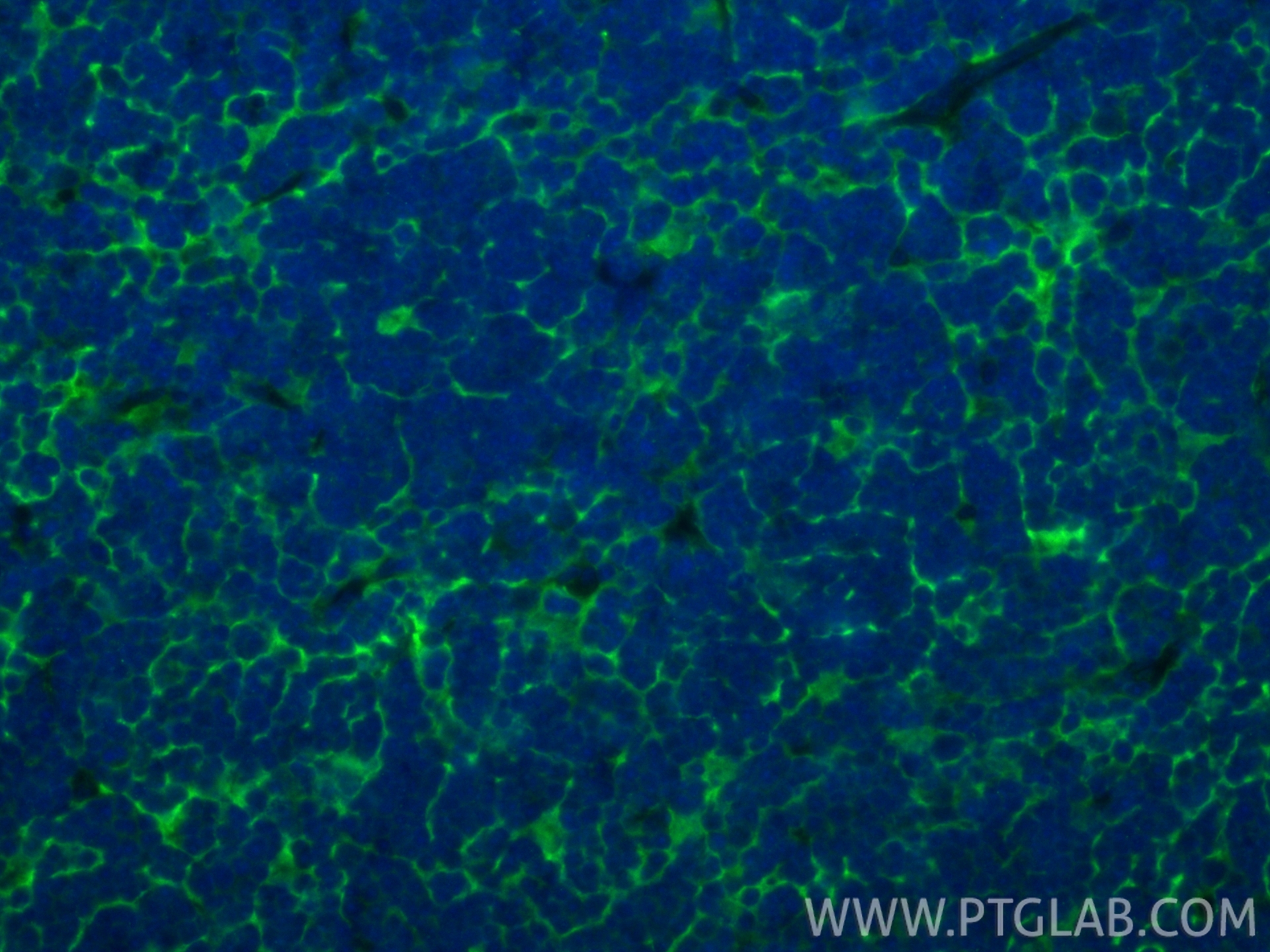 IF Staining of mouse thymus using 26304-1-AP