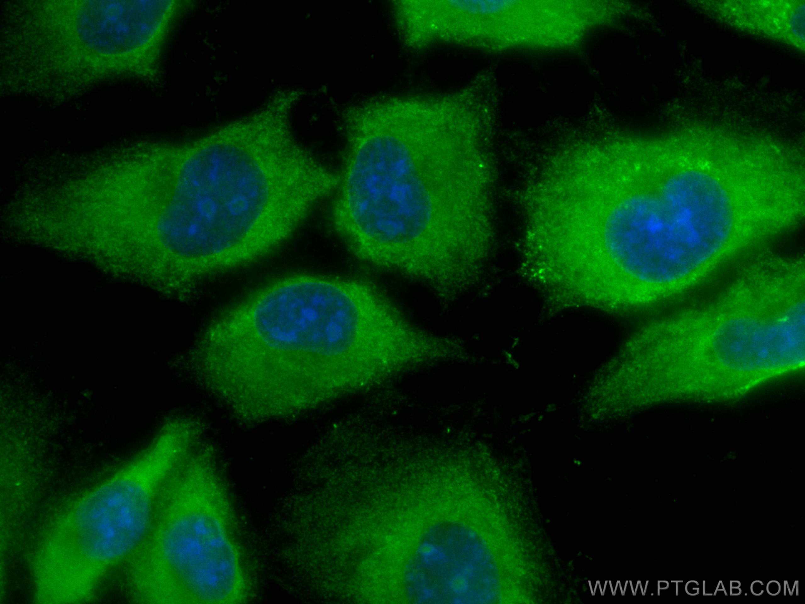 IF Staining of HUVEC using CL488-66268