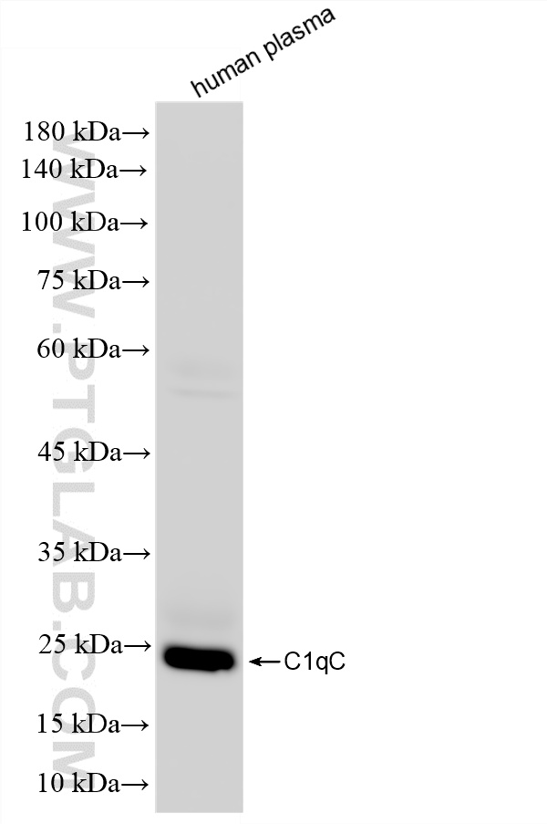 WB analysis of human plasma using HRP-85031-5 WB analysis of human plasma using HRP-85031-5