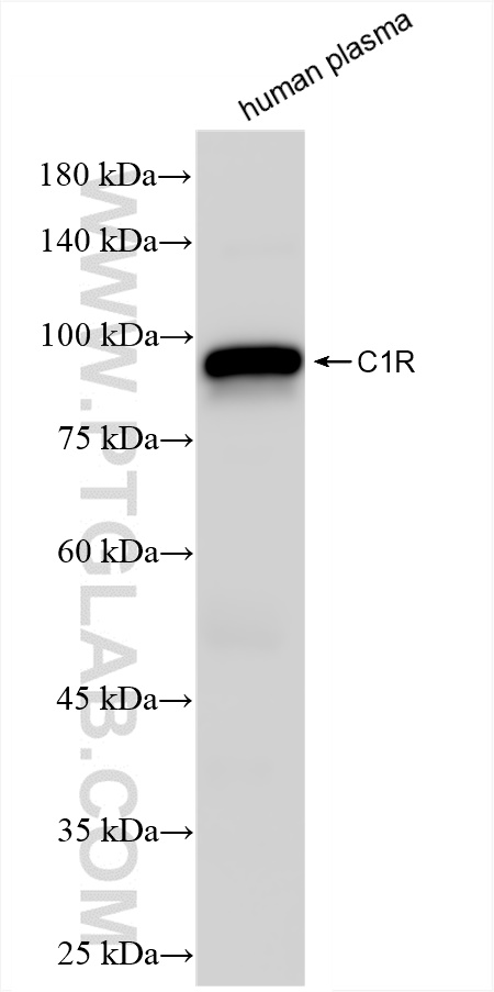 WB analysis of human plasma using 85029-4-RR