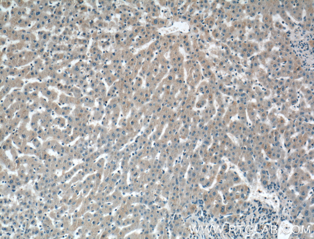 IHC staining of human liver using 27175-1-AP