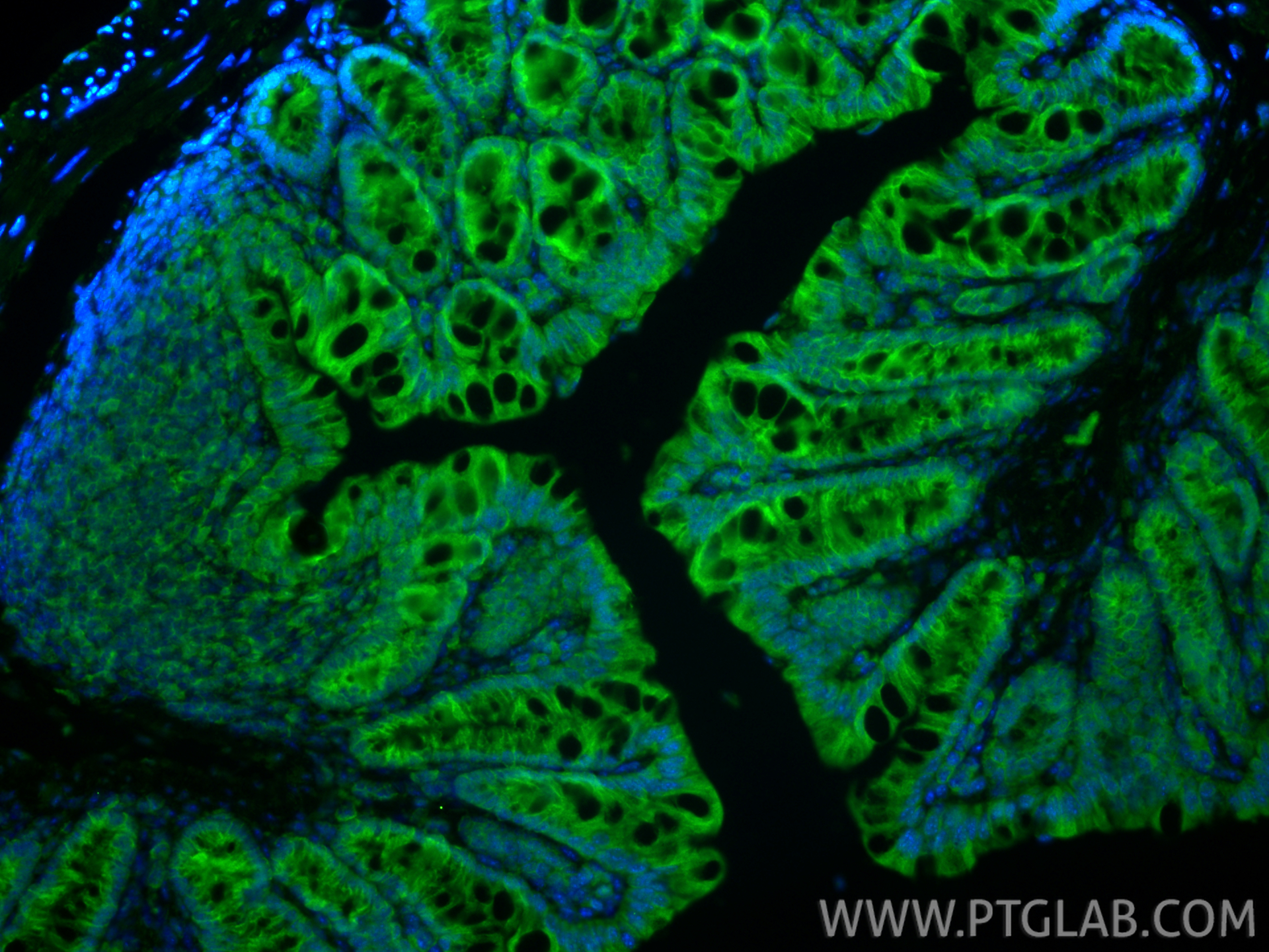 IF Staining of mouse colon using 24479-1-AP
