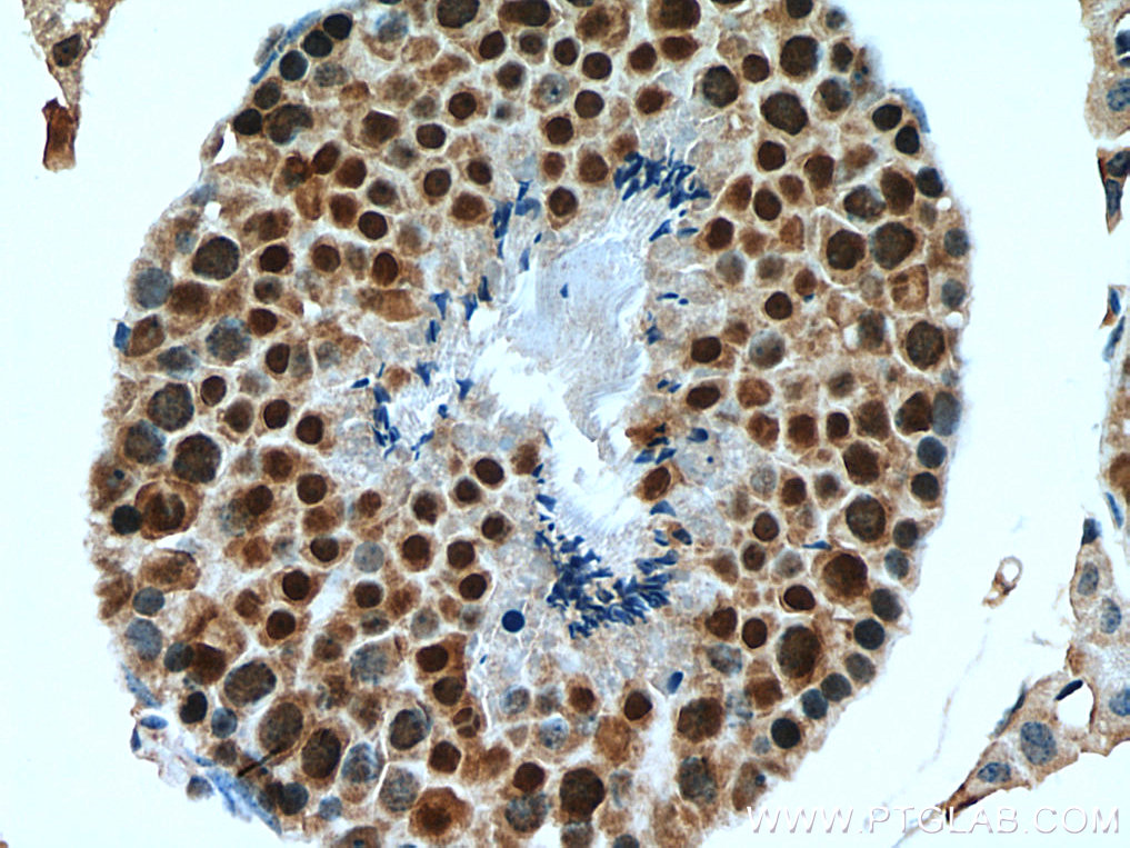 Immunohistochemical analysis of paraffin-embedded mouse testis tissue slide using 24479-1-AP (GID8 antibody) at dilution of 1:2000 (under 40x lens). Heat mediated antigen retrieval with Tris-EDTA buffer (pH 9.0). IHC staining of mouse testis using 24479-1-AP