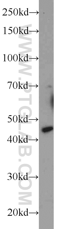 WB analysis of mouse brain using 23746-1-AP