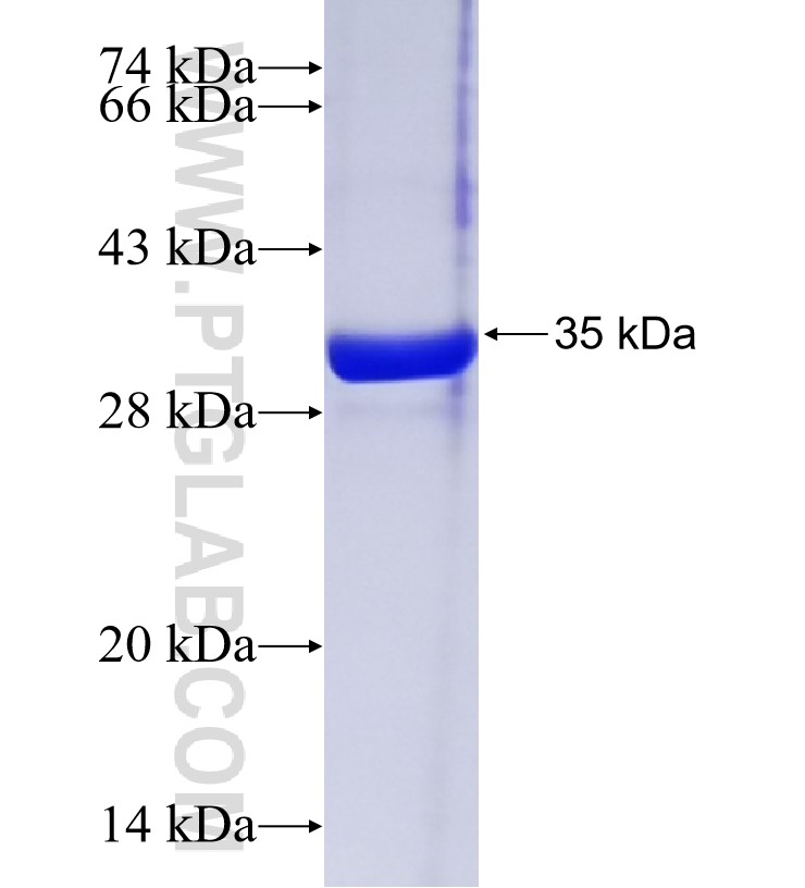 C20orf114 fusion protein Ag20056 SDS-PAGE C20orf114 fusion protein Ag20056 SDS-PAGE