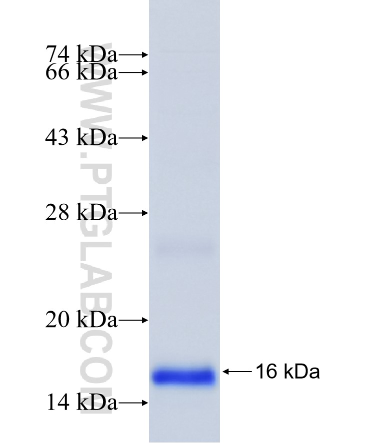 C20orf142 fusion protein Ag23781 SDS-PAGE C20orf142 fusion protein Ag23781 SDS-PAGE