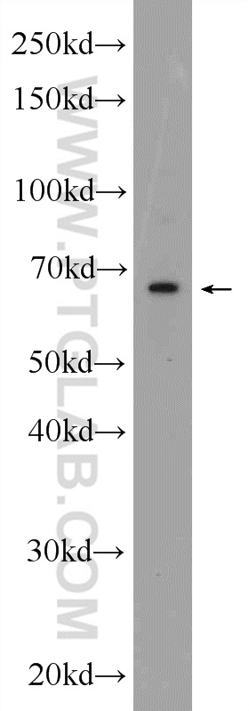 C20orf152