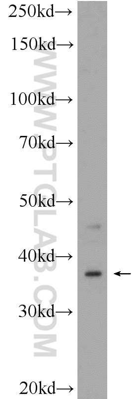 WB analysis of HepG2 using 16040-1-AP