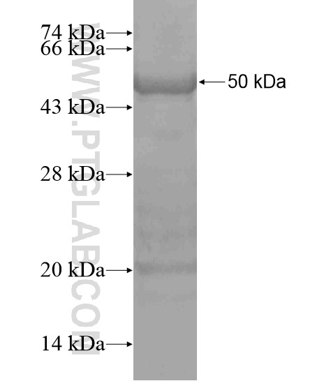 C20orf196 fusion protein Ag19727 SDS-PAGE C20orf196 fusion protein Ag19727 SDS-PAGE