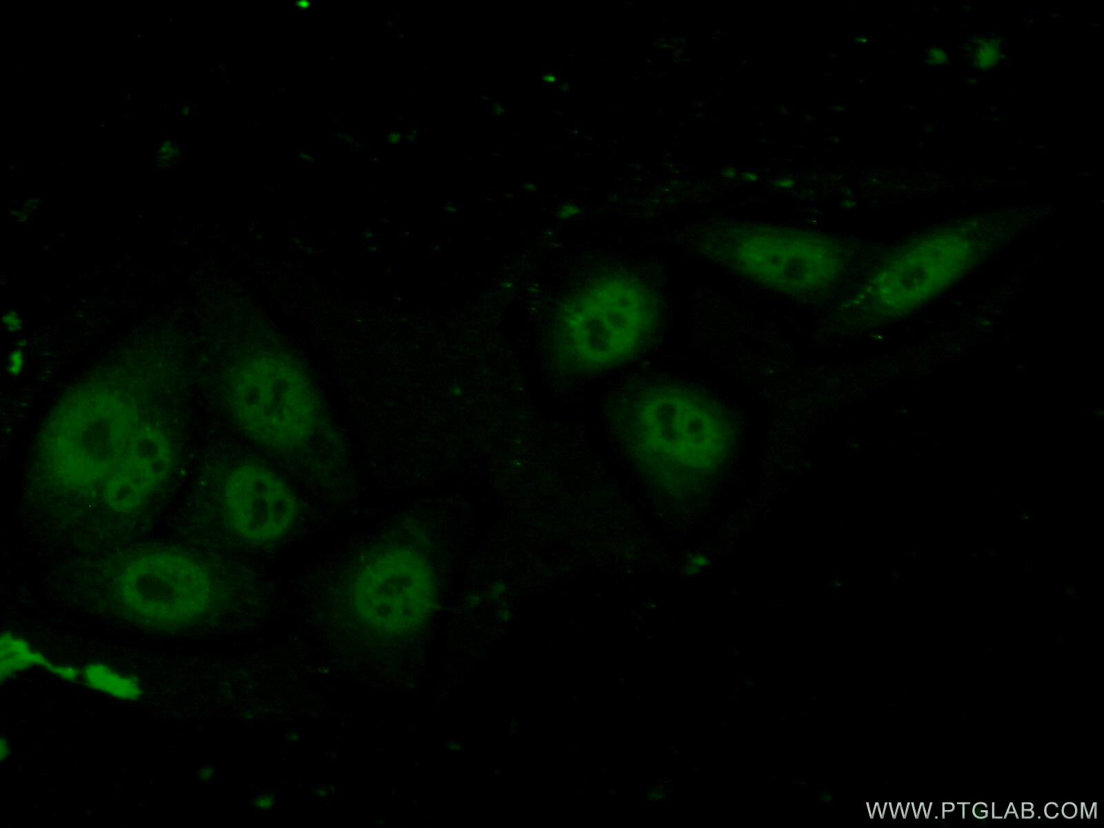 IF Staining of HepG2 using 26040-1-AP