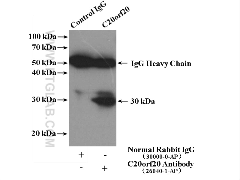 IP experiment of HepG2 using 26040-1-AP