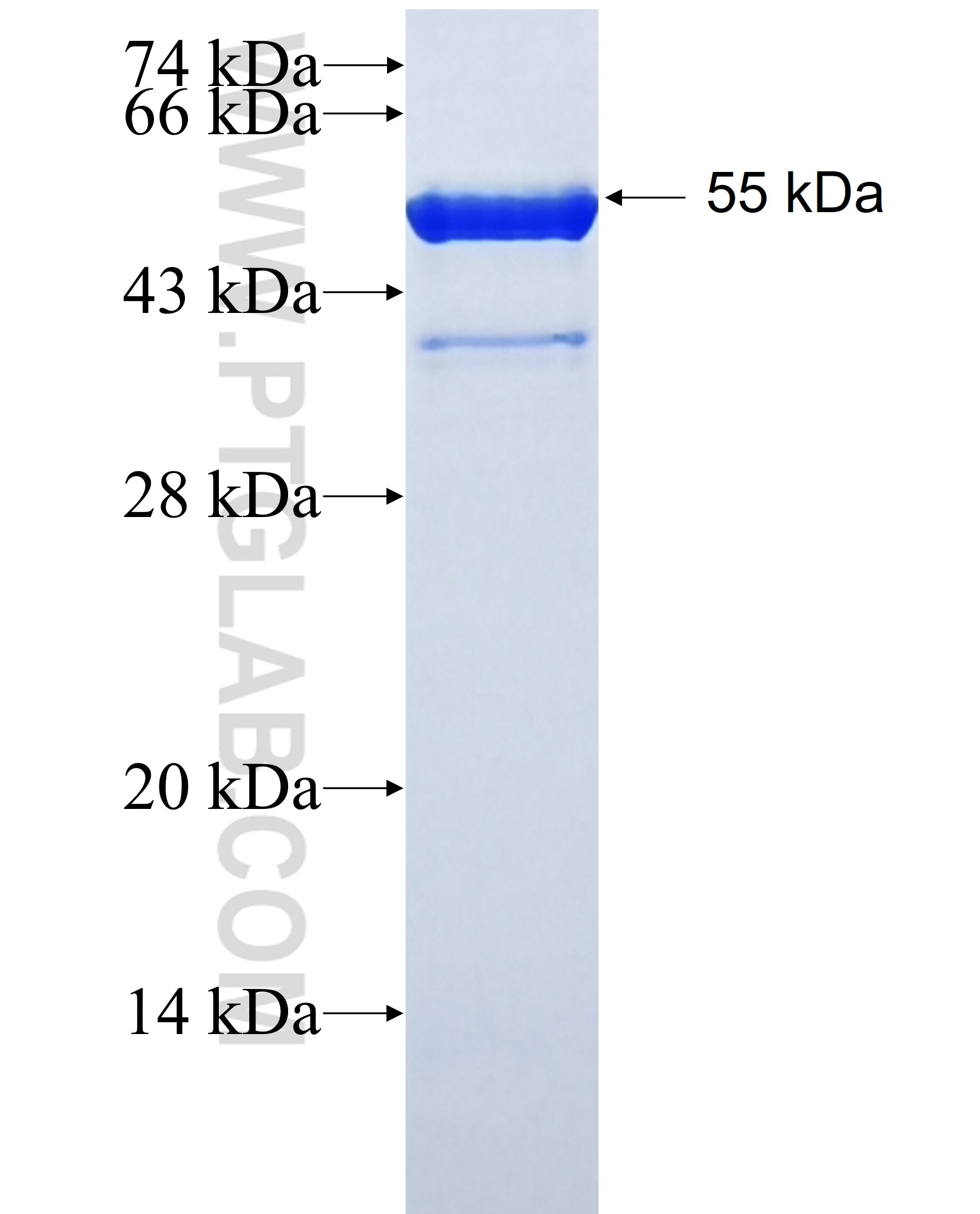 C20orf20 fusion protein Ag22840 SDS-PAGE