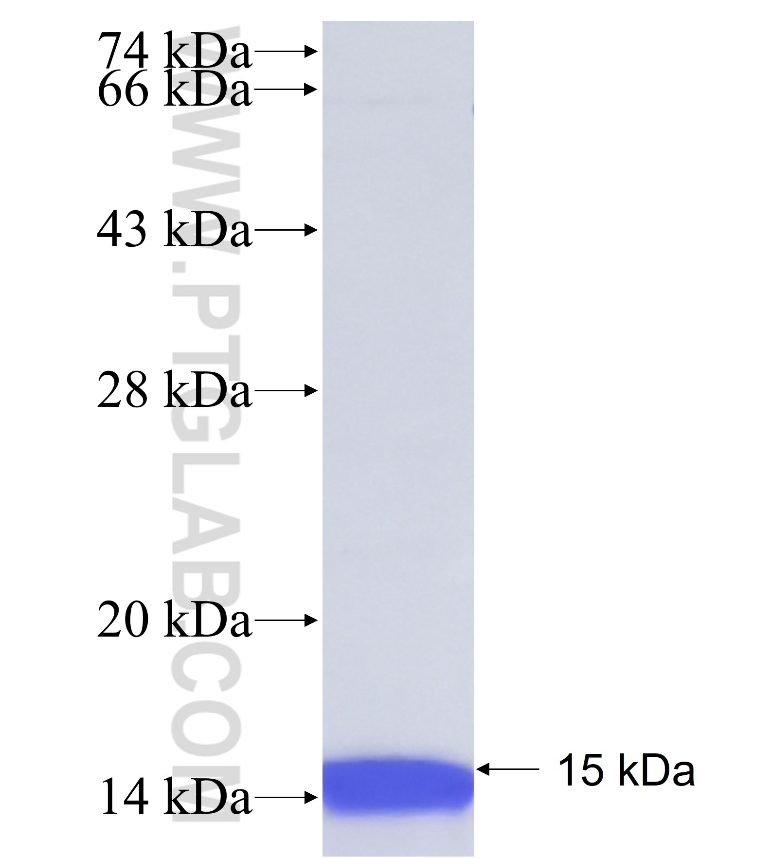 C20orf24 fusion protein Ag38753 SDS-PAGE C20orf24 fusion protein Ag38753 SDS-PAGE