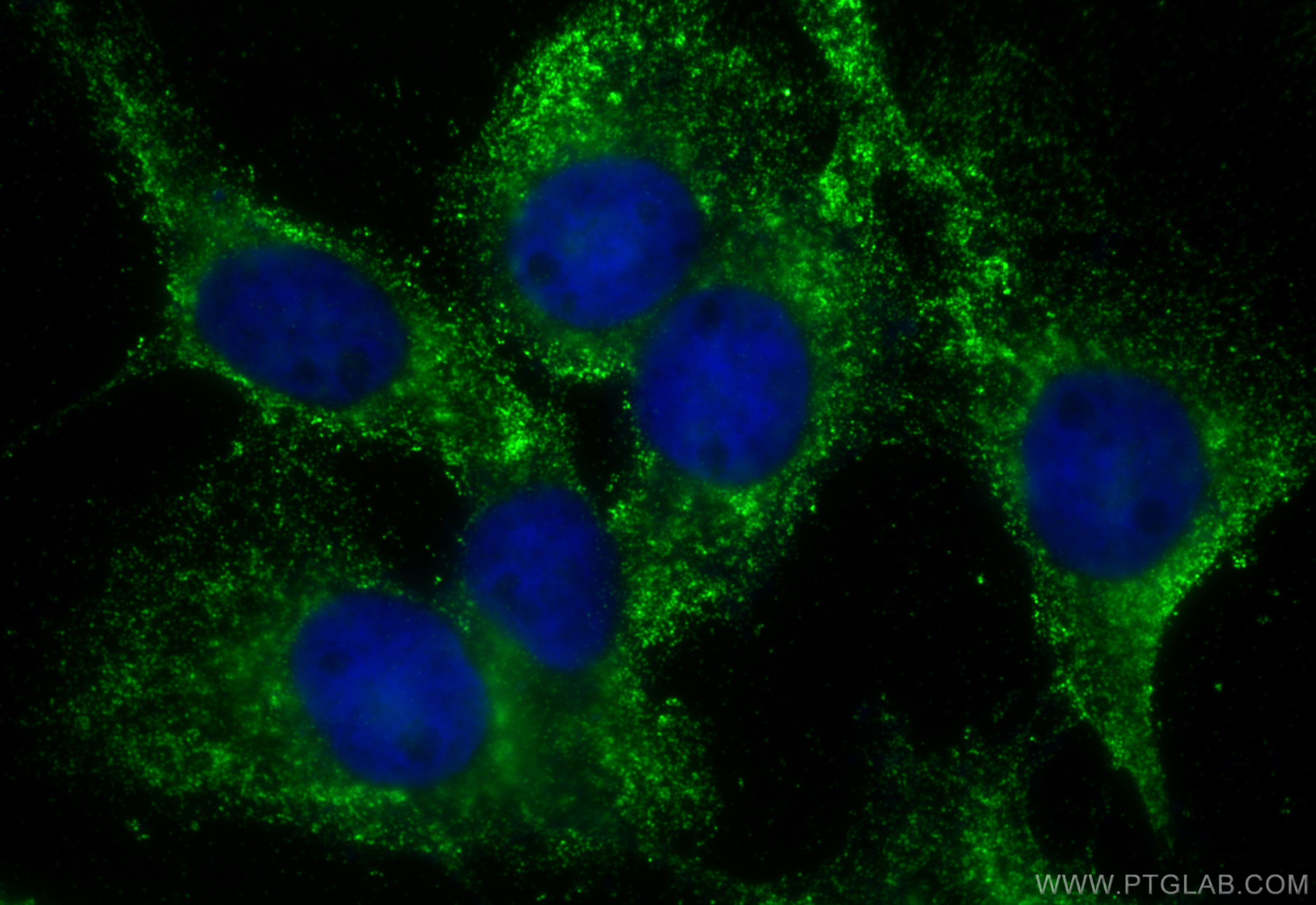IF Staining of A431 using 31427-1-AP