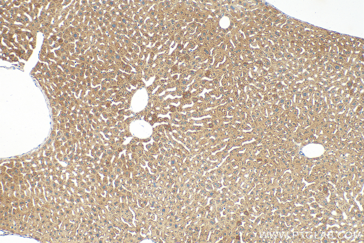 IHC staining of mouse liver using 31427-1-AP
