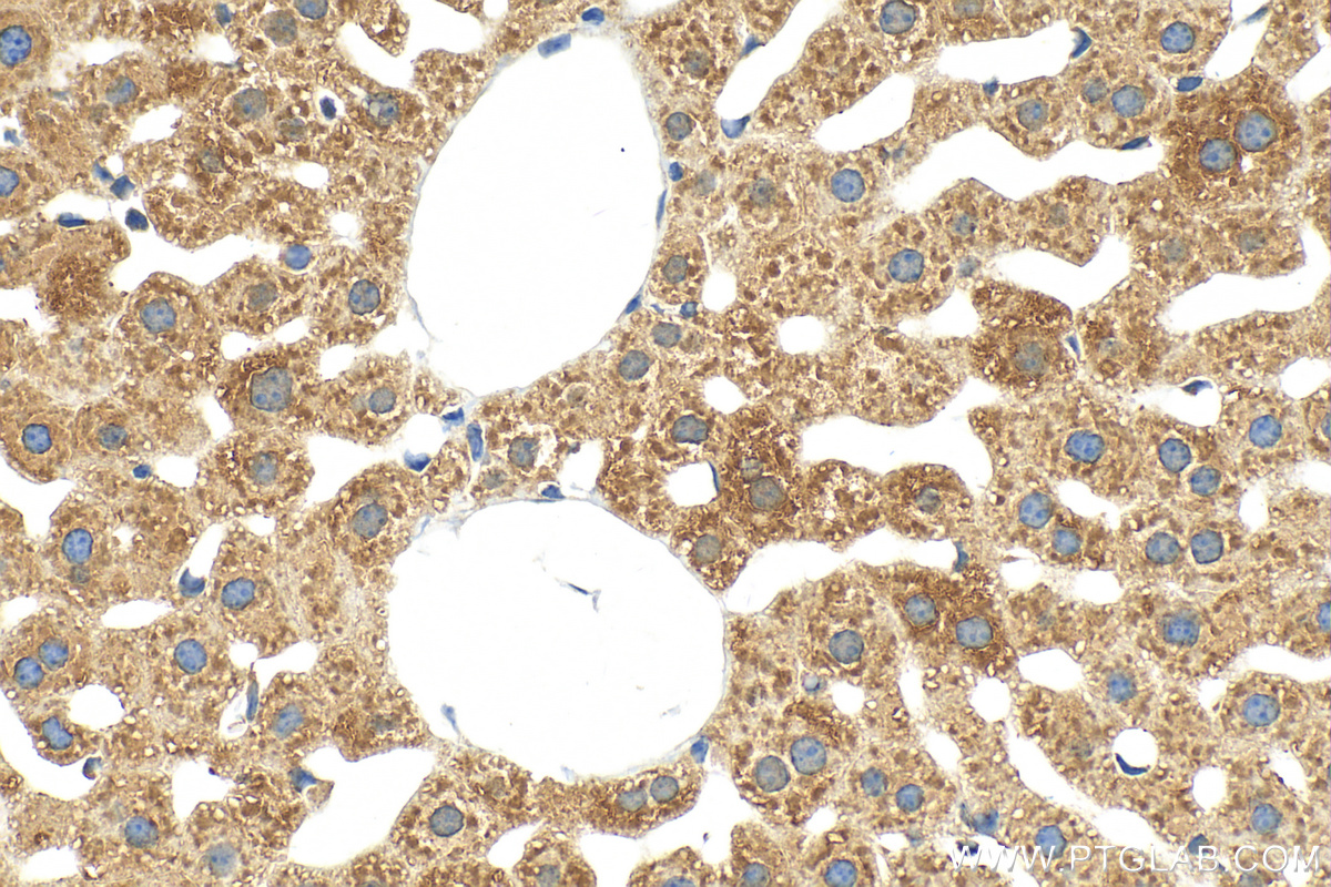 IHC staining of mouse liver using 31427-1-AP