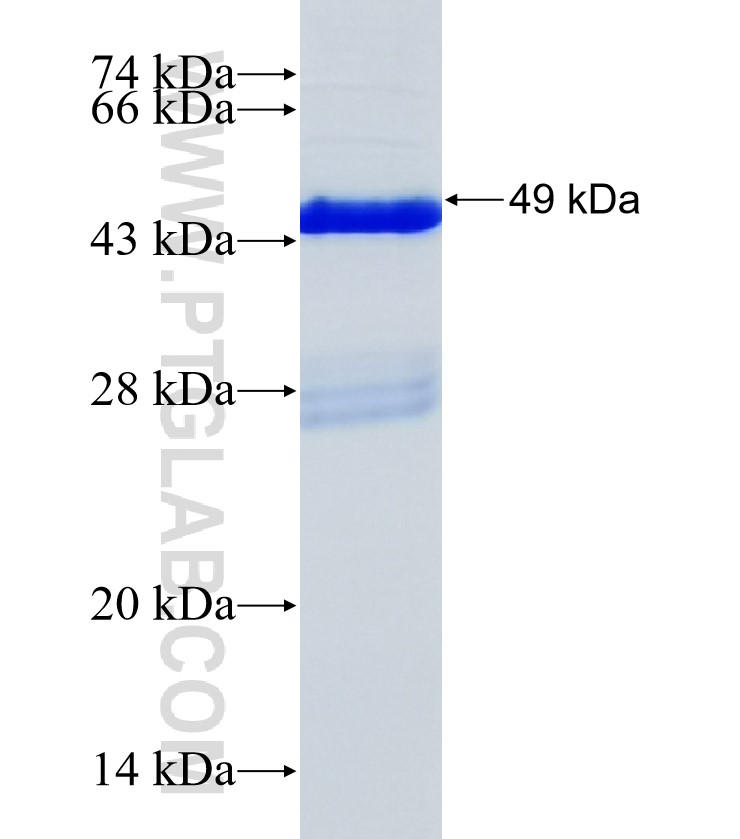 C20orf26 fusion protein Ag35425 SDS-PAGE