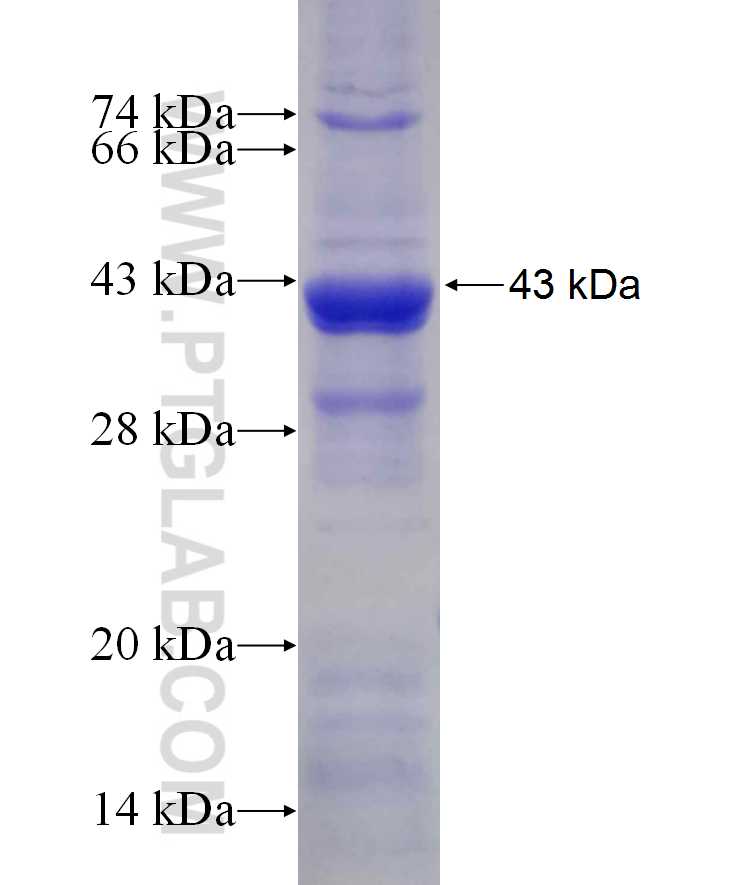 C20orf3 fusion protein Ag29996 SDS-PAGE