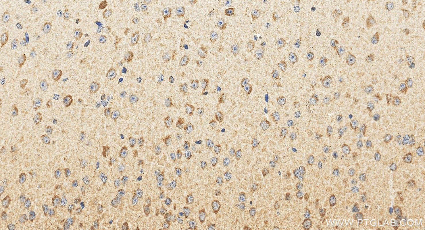 IHC staining of mouse brain using 21466-1-AP IHC staining of mouse brain using 21466-1-AP