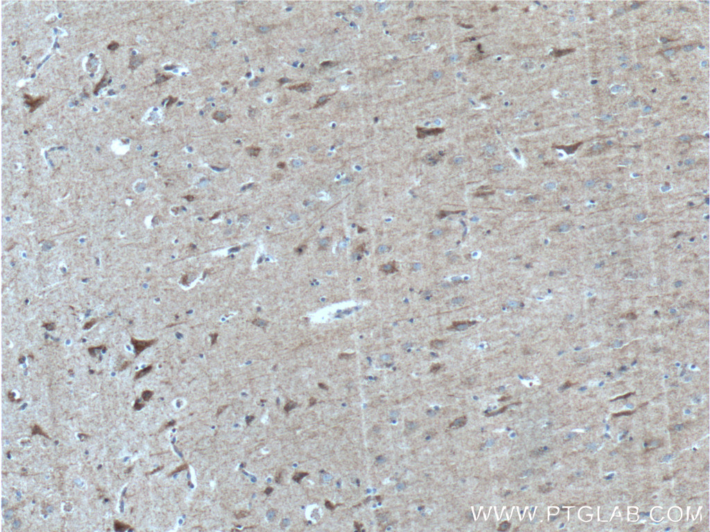 IHC staining of human brain using 27537-1-AP