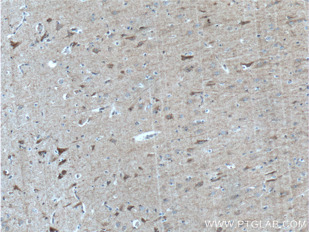 IHC staining of human brain using 27537-1-AP (same clone as 27537-1-PBS)