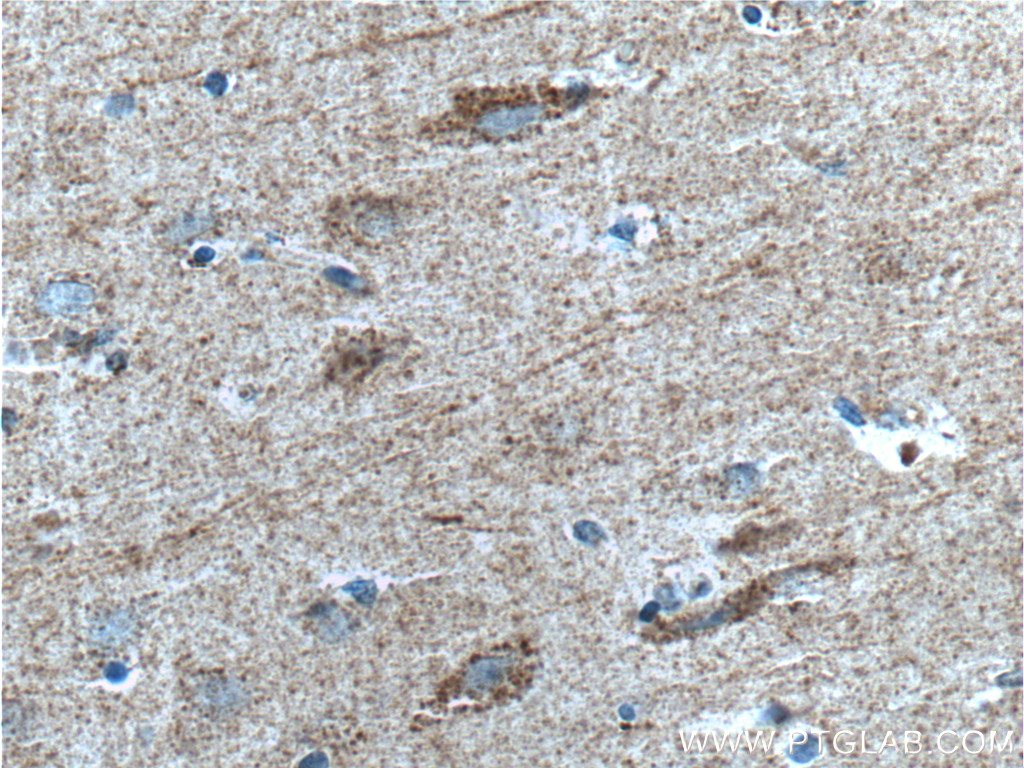 IHC staining of human brain using 27537-1-AP (same clone as 27537-1-PBS)