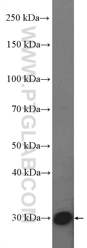 WB analysis of mouse heart using 27537-1-AP