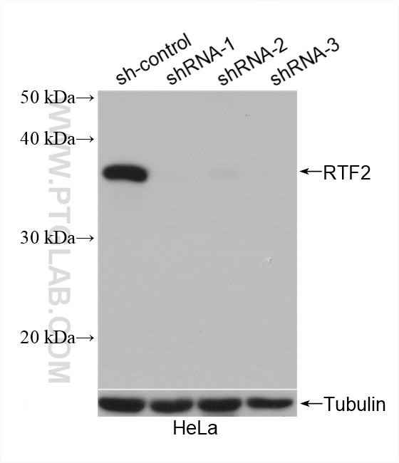 WB analysis of HeLa using 16633-1-AP