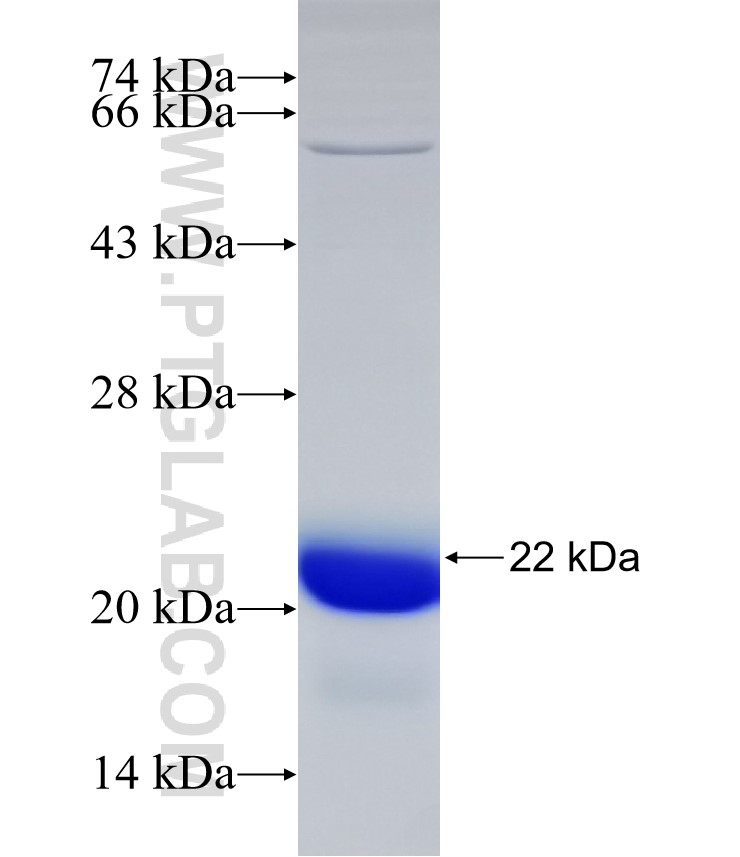 C20orf46 fusion protein Ag33049 SDS-PAGE C20orf46 fusion protein Ag33049 SDS-PAGE