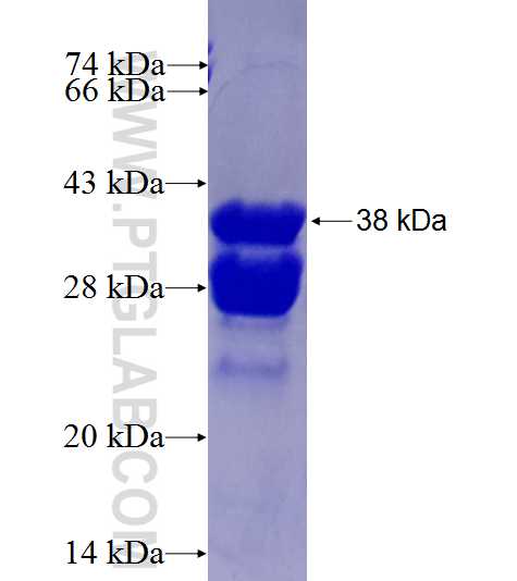 C20orf70 fusion protein Ag27401 SDS-PAGE