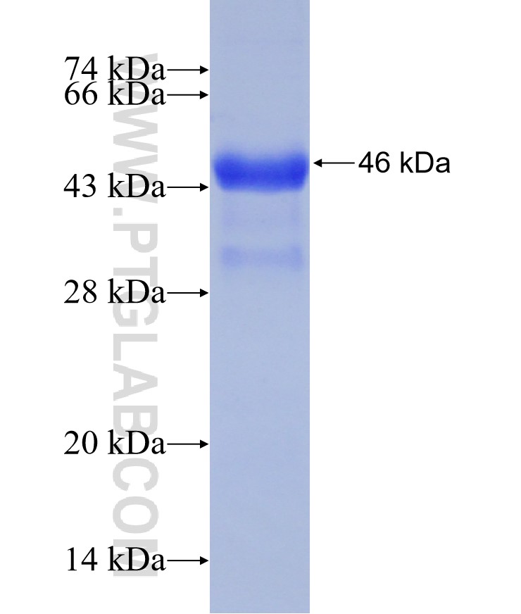C20orf74 fusion protein Ag31460 SDS-PAGE