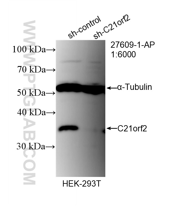 WB analysis of HEK-293T using 27609-1-AP WB analysis of HEK-293T using 27609-1-AP