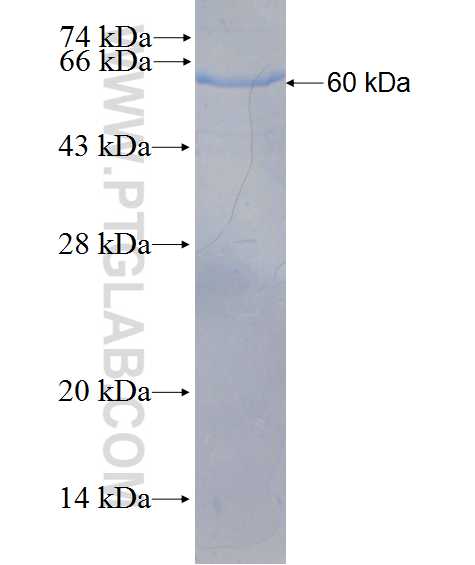 C21orf2 fusion protein Ag26470 SDS-PAGE