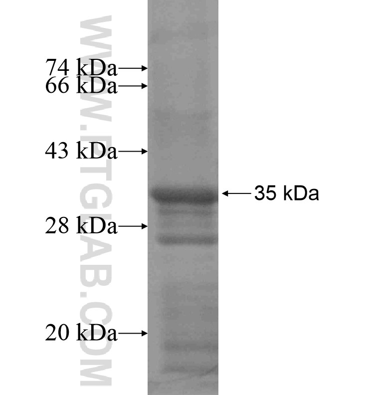 C21orf34 fusion protein Ag16643 SDS-PAGE C21orf34 fusion protein Ag16643 SDS-PAGE