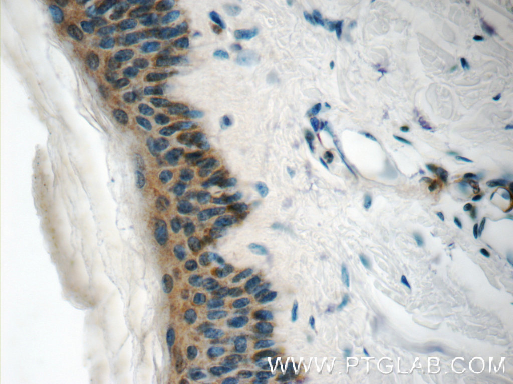 IHC staining of human skin using 25024-1-AP